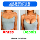 Aumento de Seio ampliar busto- Sadoer