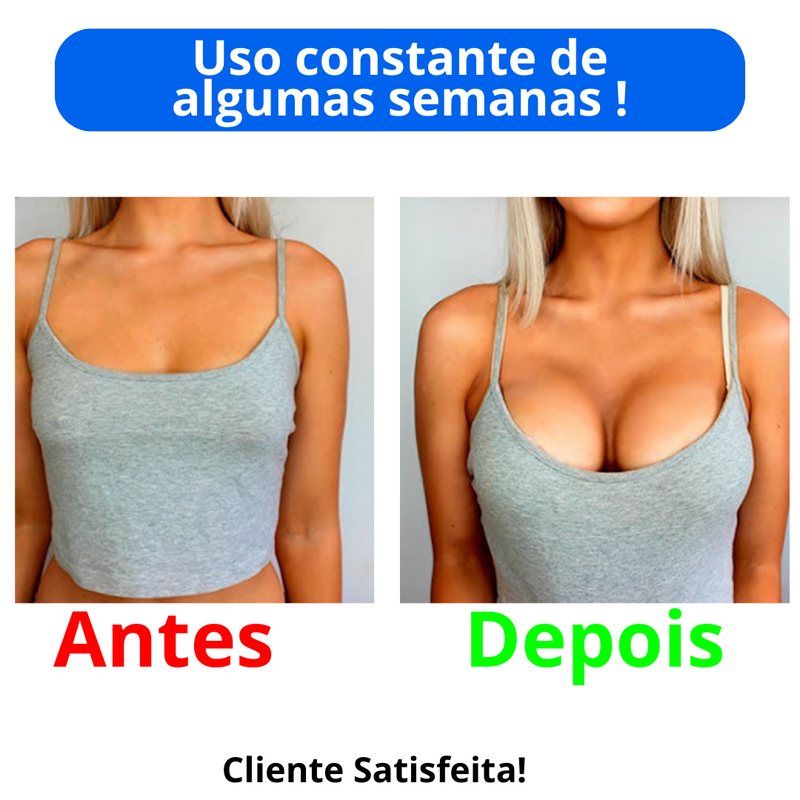 Aumento de Seio ampliar busto- Sadoer