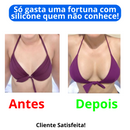 Aumento de Seio ampliar busto- Sadoer