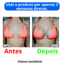 Aumento de Seio ampliar busto- Sadoer